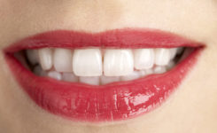 Frau mit weißen Zähnen nach dem Bleaching