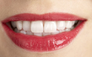 Frau mit weißen Zähnen nach dem Bleaching